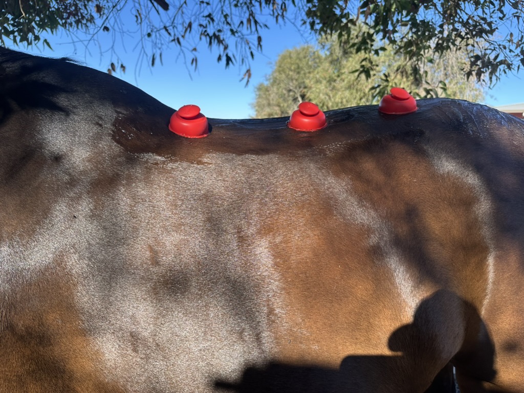 Cupping